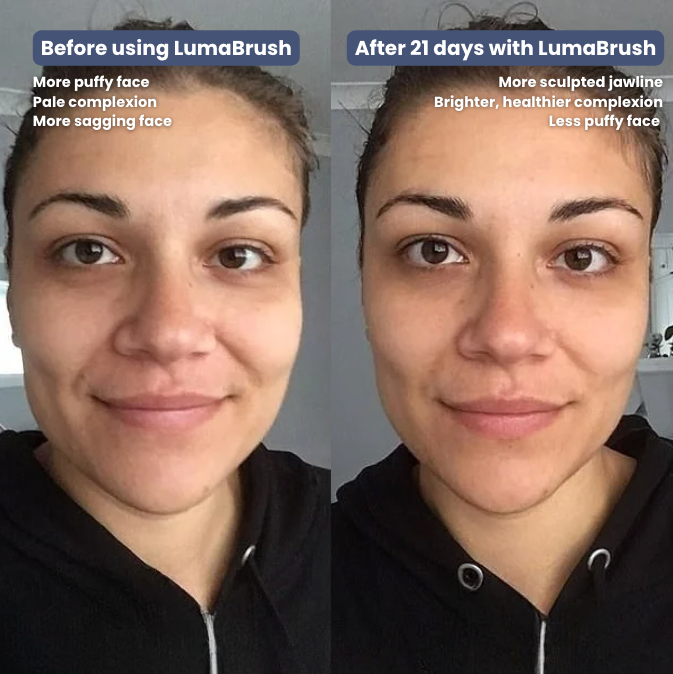 NEW LumaBrush™ 2.0 : Lymphatic Face Brush